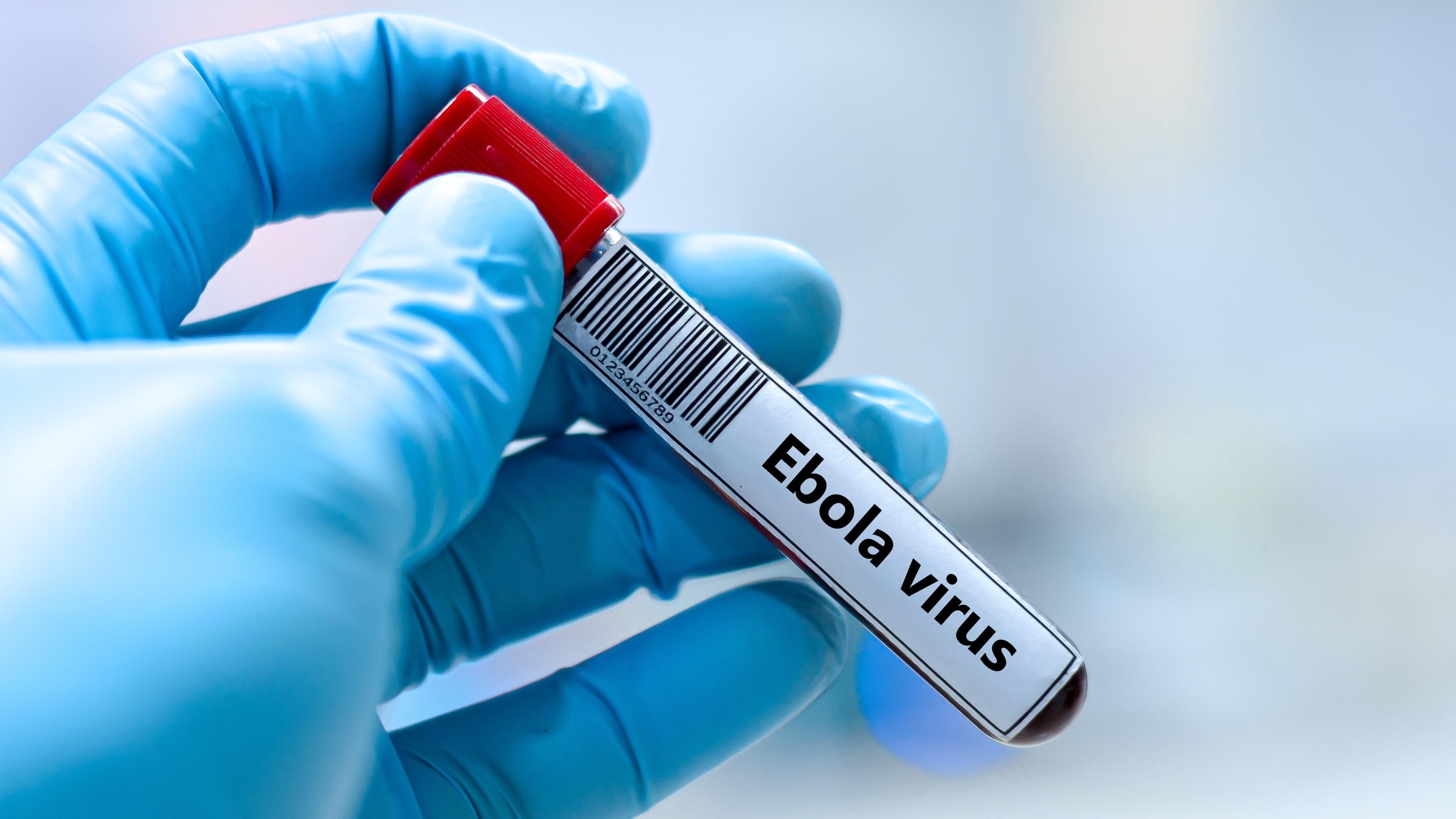 American citizen tests positive for Ebola. Photo: Shutterstock 