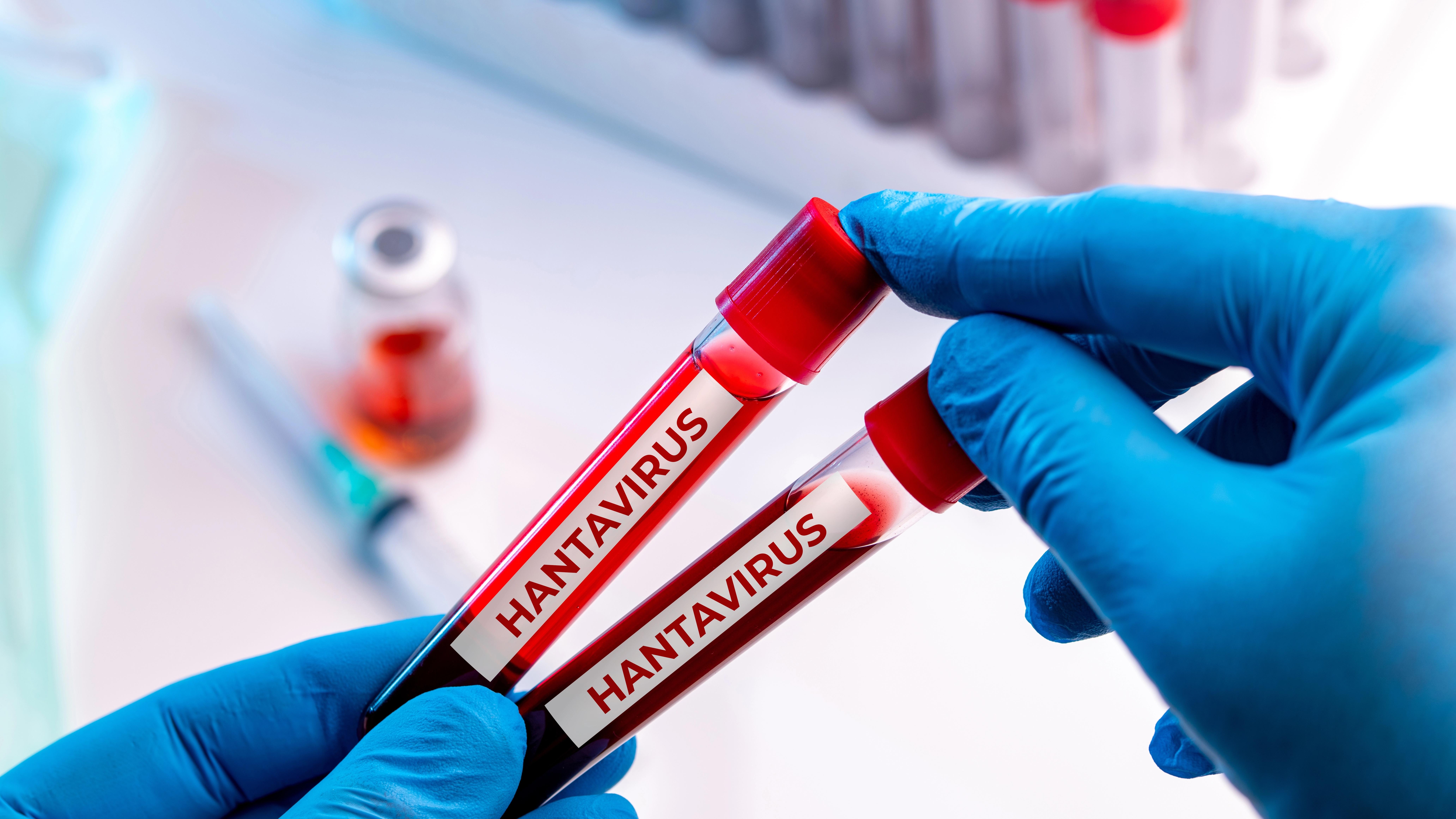 Another Hantavirus case confirmed in Spain. Photo: Shutterstock 
