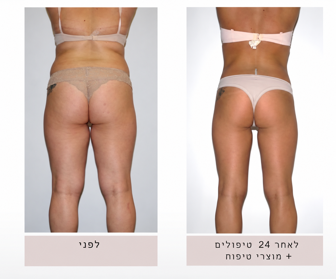 לפני ואחרי. צילום באדיבות המקום